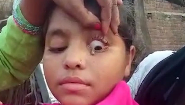 لڑکی کی آنکھوں سے آنسو کے بجائے پتھر بہنے لگے