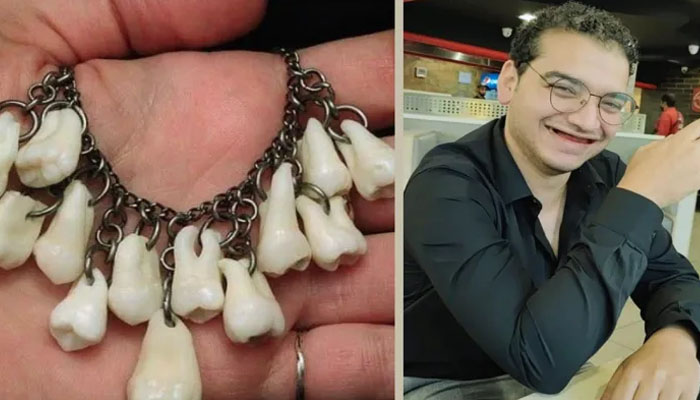 سچی محبت کا ثبوت: لڑکے نے گرل فرینڈ کیلئے اپنے دانتوں کا ہار بنا ڈالا