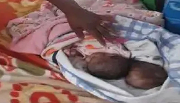 بھارت: دو سروں والے بچے کی پیدائش پر والدین اسپتال سے فرار