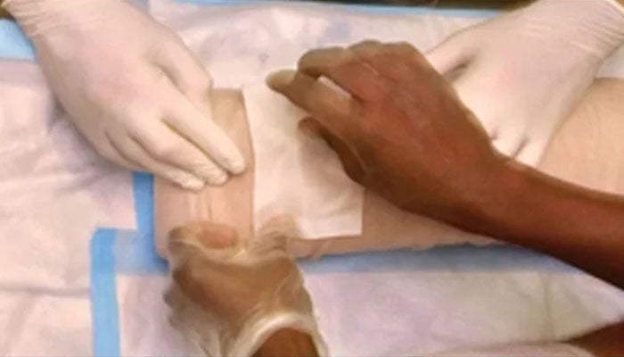 مریض کی غلط ٹانگ کاٹنے والی خاتون ڈاکٹر کو سزا