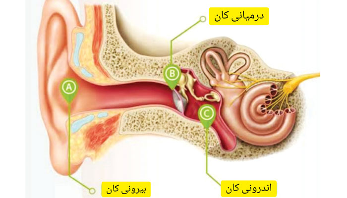 صوتی آلودگی سماعت کی خرابی کا سب سے بڑا سبب