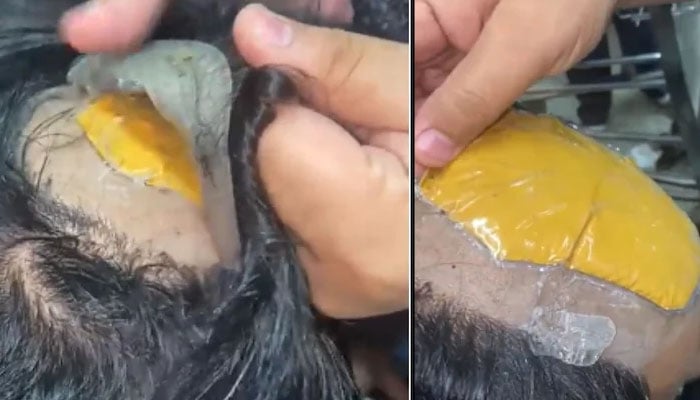 ویڈیو: مسافر نے اپنی وِگ میں 30 لاکھ روپے کا سونا چُھپالیا