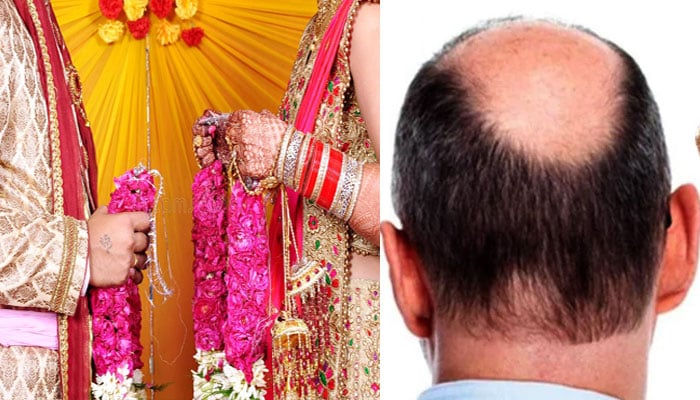 بھارت، دولہے کی وِگ اتر گئی، دلہن نے شادی سے انکار کردیا