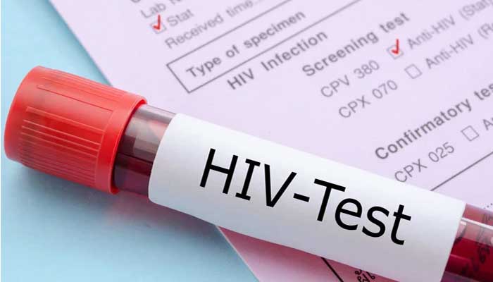 ایڈز کے مریضوں کی تعداد سے متعلق رپورٹ پنجاب اسمبلی میں پیش