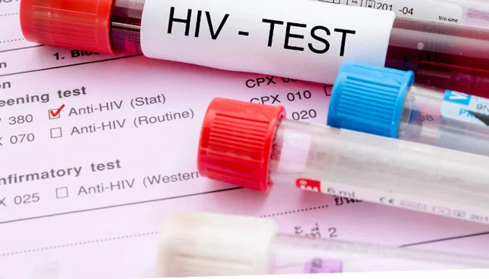 دنیا بھر میں ایچ آئی وی سے آگاہی کا دن آج منایا جارہا ہے
