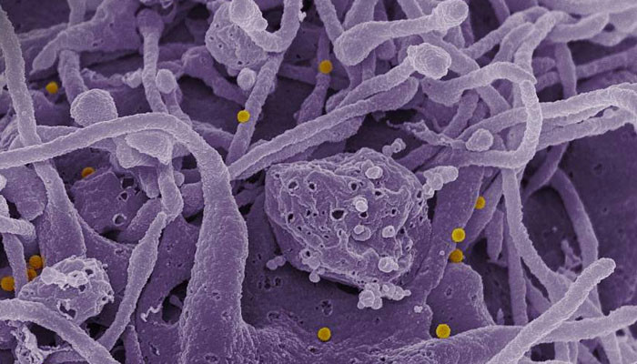 کوئٹہ: ایک اور مریض میں کانگو وائرس کی تصدیق کوئٹہ: ایک اور مریض میں کانگو وائرس کی تصدیق