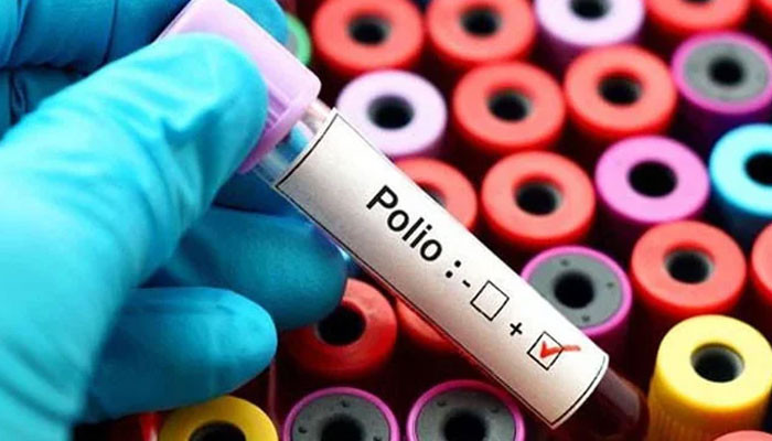 پولیو وائرس: مثبت نمونوں کی تعداد 43 ہو گئی پولیو وائرس: مثبت نمونوں کی تعداد 43 ہو گئی