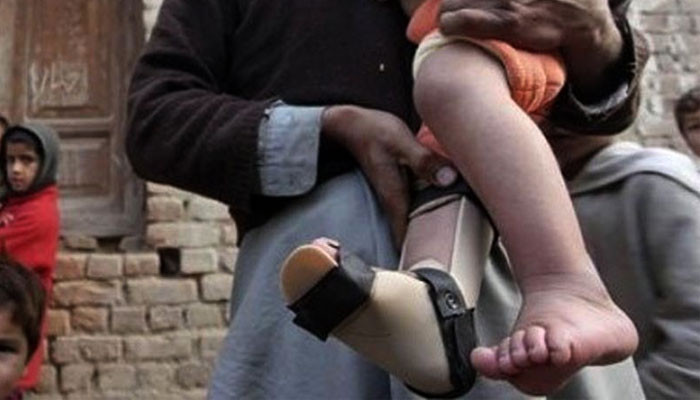 کراچی: 2 سال کے بچے میں پولیو وائرس کی تصدیق کراچی: 2 سال کے بچے میں پولیو وائرس کی تصدیق