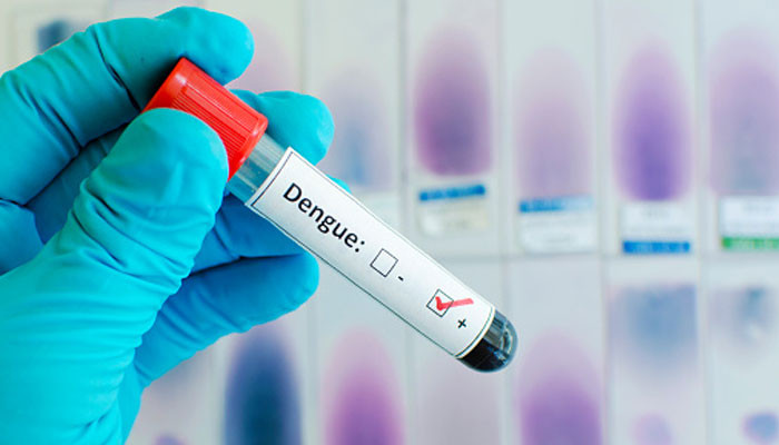 پنجاب: مزید 202 افراد ڈینگی وائرس کا شکار پنجاب: مزید 202 افراد ڈینگی وائرس کا شکار