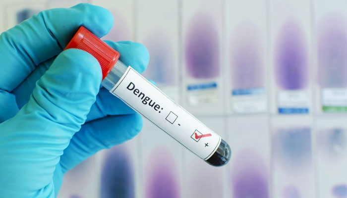 راولپنڈی: مزید 21 افراد میں ڈینگی وائرس کی تصدیق راولپنڈی: مزید 21 افراد میں ڈینگی وائرس کی تصدیق