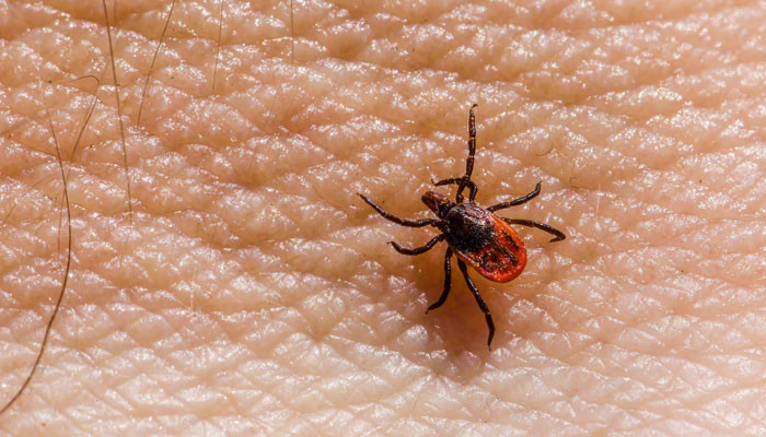 کوئٹہ: زیرِ علاج کانگو وائرس کے مریض کا انتقال کوئٹہ: زیرِ علاج کانگو وائرس کے مریض کا انتقال