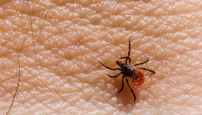 بلوچستان سے کراچی آیا ایک اور کانگو مریض ڈسچارج