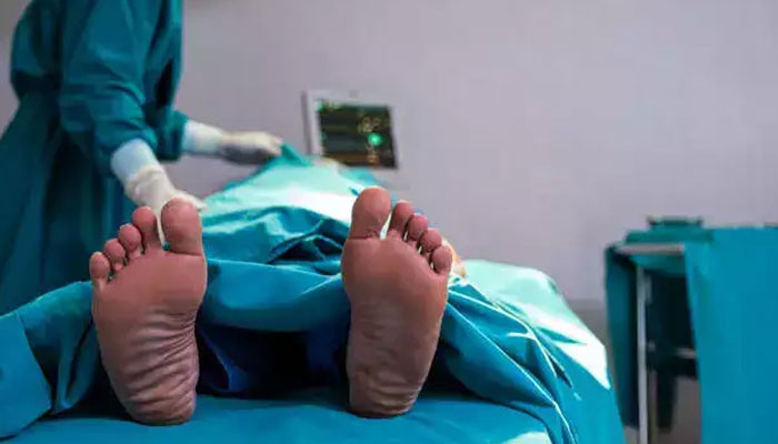 کراچی: کانگو سے متاثرہ مریض انتقال کر گیا