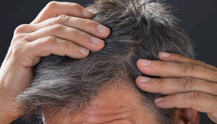 انسانی بال سفید کیوں ہوتے ہیں؟ انسانی بال سفید کیوں ہوتے ہیں؟