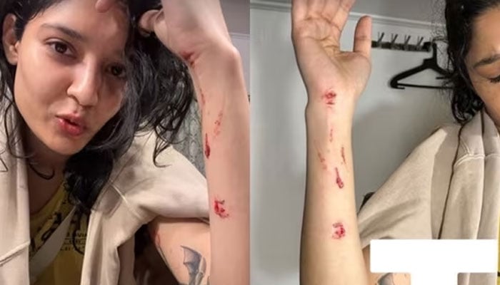 تامل اداکارہ ریتیکا سنگھ شوٹنگ کے دوران زخمی، تصویر اور ویڈیو شیئر کردی