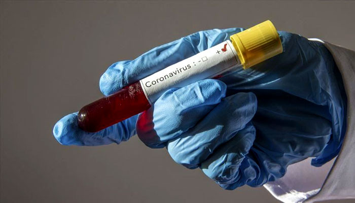 محکمہ صحت پنجاب کا صوبے میں دوبارہ کورونا ٹیسٹنگ شروع کرنے کا فیصلہ