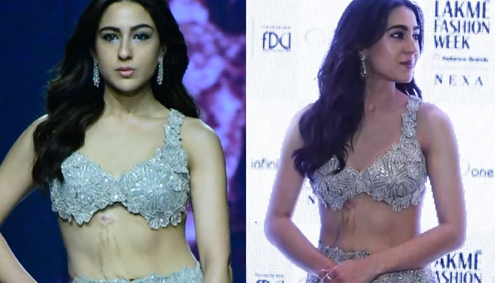 Sara Ali Khan's burn mark grabs attention at Lakme Fashion Week