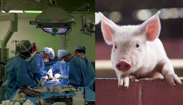 Successful pig kidney transplant into living man