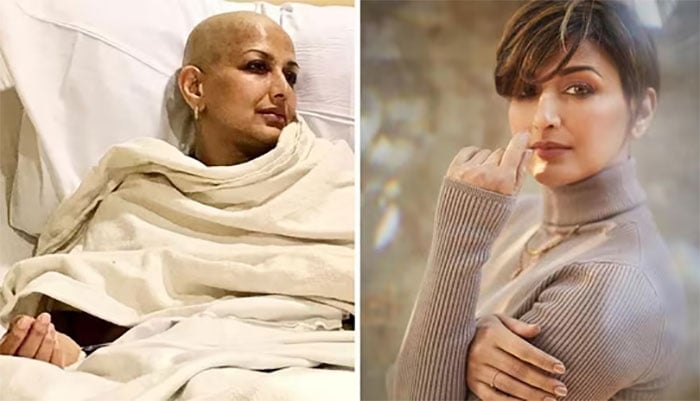 سونالی نے کینسر کا مقابلہ کس طرح کیا؟
