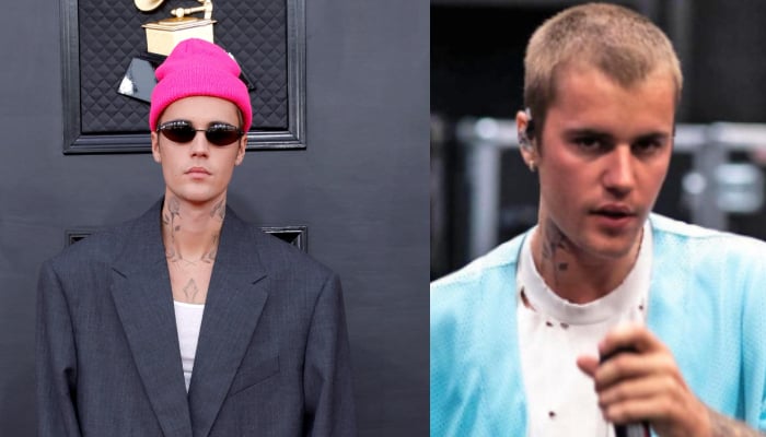 Did Justin Bieber get a secret hair transplant? DETAILS