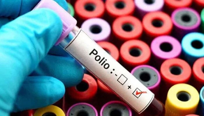 میر پور خاص سے پولیو وائرس کا پہلا مثبت نمونہ سامنے آگیا: فائل فوٹو