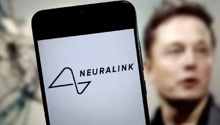 Elon Musk's Neuralink addresses technical issues following first human brain implant