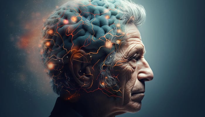 Neurologists discover new biomarker to indicate Alzheimer 