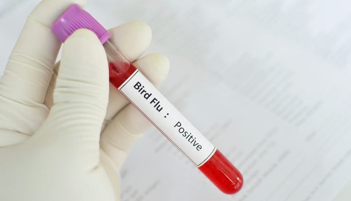 Child tests positive for bird flu in Australia 