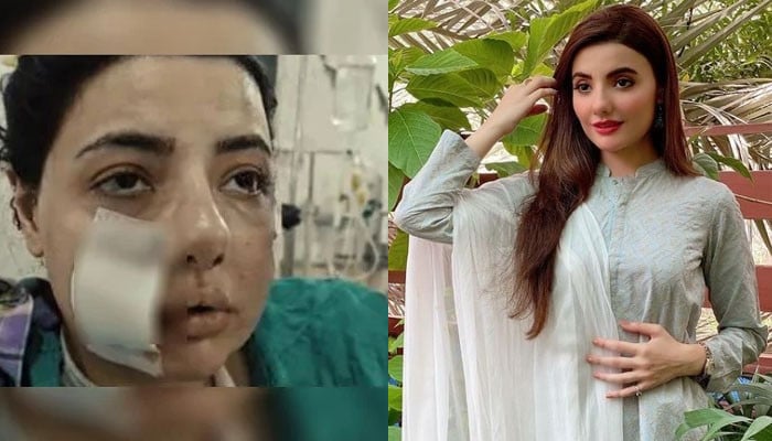 زخمی سابقہ اداکارہ زینب جمیل / اسکرین گریب