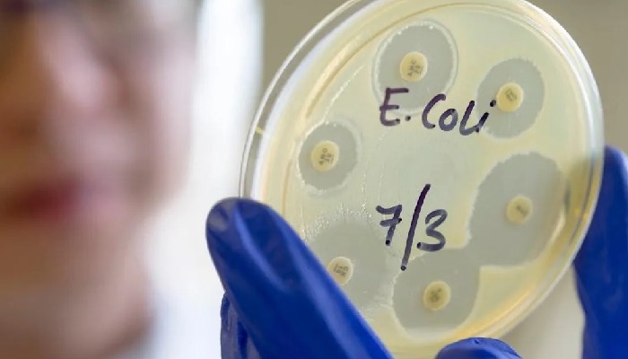 E. coli outbreak in England claims two lives, 275 infected