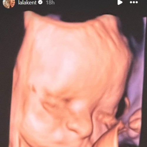 Pregnant Lala Kent shares 4D ulttrasound image of her soon-to-be born baby