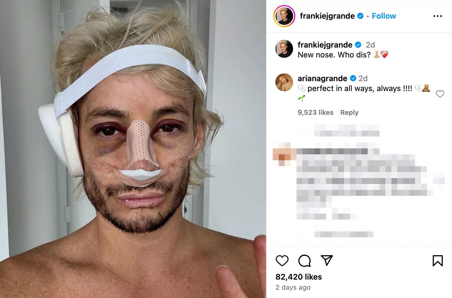 Ariana Grande approves of brother Frankies nose job: Perfect