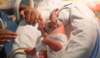 پاکستان میں سالانہ 75 ہزار سے زائد بچے دل کی بیماریوں کے ساتھ پیدا ہوتے ہیں 