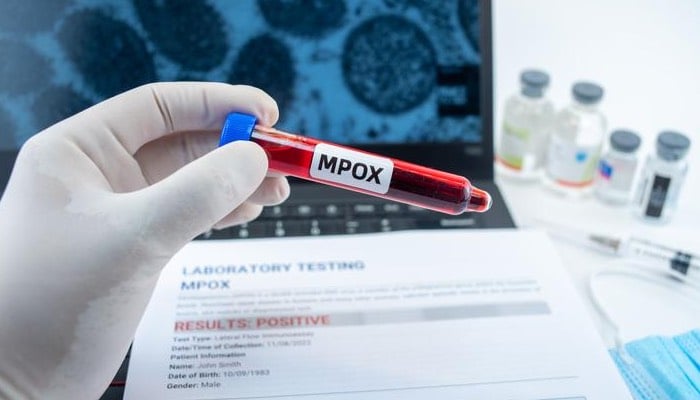 WHO approves first rapid diagnostic test for mpox