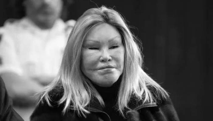 Jocelyn Wildenstein, ‘Catwoman’ socialite, dies at 84