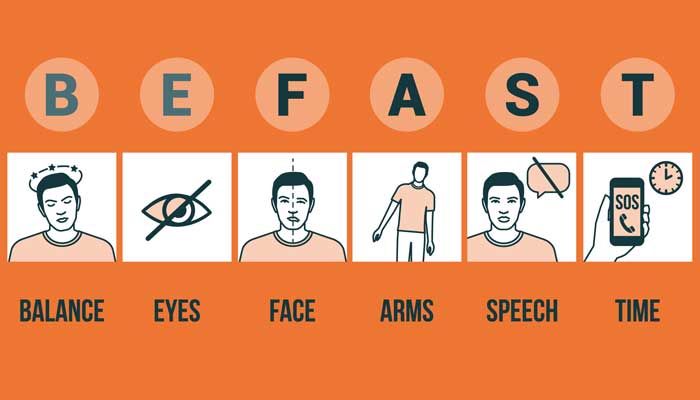 BE FAST guidelines helps spot signs of stroke