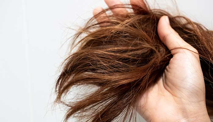 How to get rid of dry hair with these easy steps