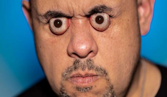 سب سے زیادہ آنکھیں باہر نکالنے کا عالمی ریکارڈ