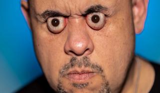 سب سے زیادہ آنکھیں باہر نکالنے کا عالمی ریکارڈ