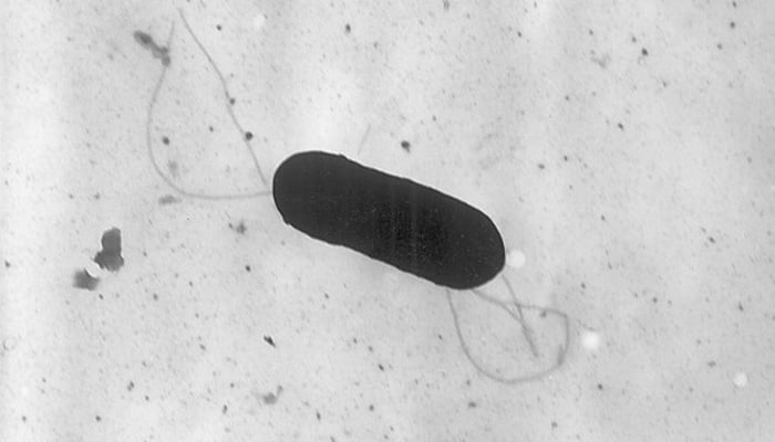 Food company recalls products after Listeria outbreak sickens 10