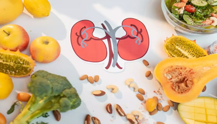 Essential food items to prevent kidney stones