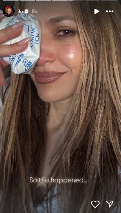 Jennifer Lopez suffers painful injury ahead of 2025 American Music Awards