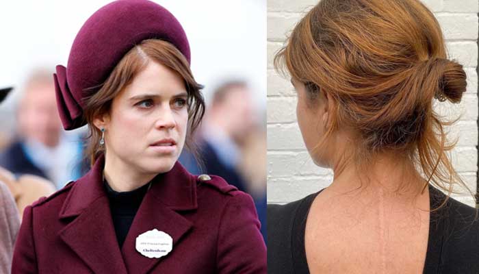 Princess Eugenie discusses childhood spinal surgery during recent hospital visit
