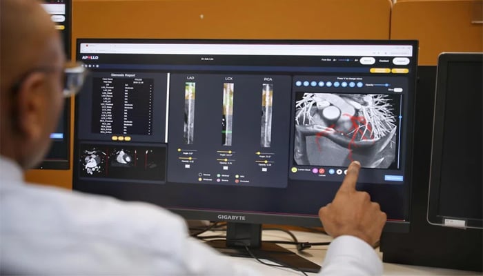 Singapore’s AI-centric Sense system targets precised coronary artery disease diagnosis