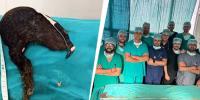  14 سالہ لڑکی کے معدے سے دنیا کا سب سے لمبا بالوں کا گچھا نکال لیا گیا