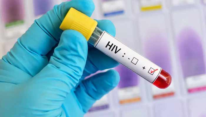 فلپائن میں ایچ آئی وی کیسز میں 500 فیصد اضافہ، ہیلتھ ایمرجنسی نافذ