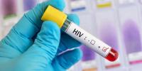فلپائن میں ایچ آئی وی کے کیسز 500 فیصد بڑھ گئے