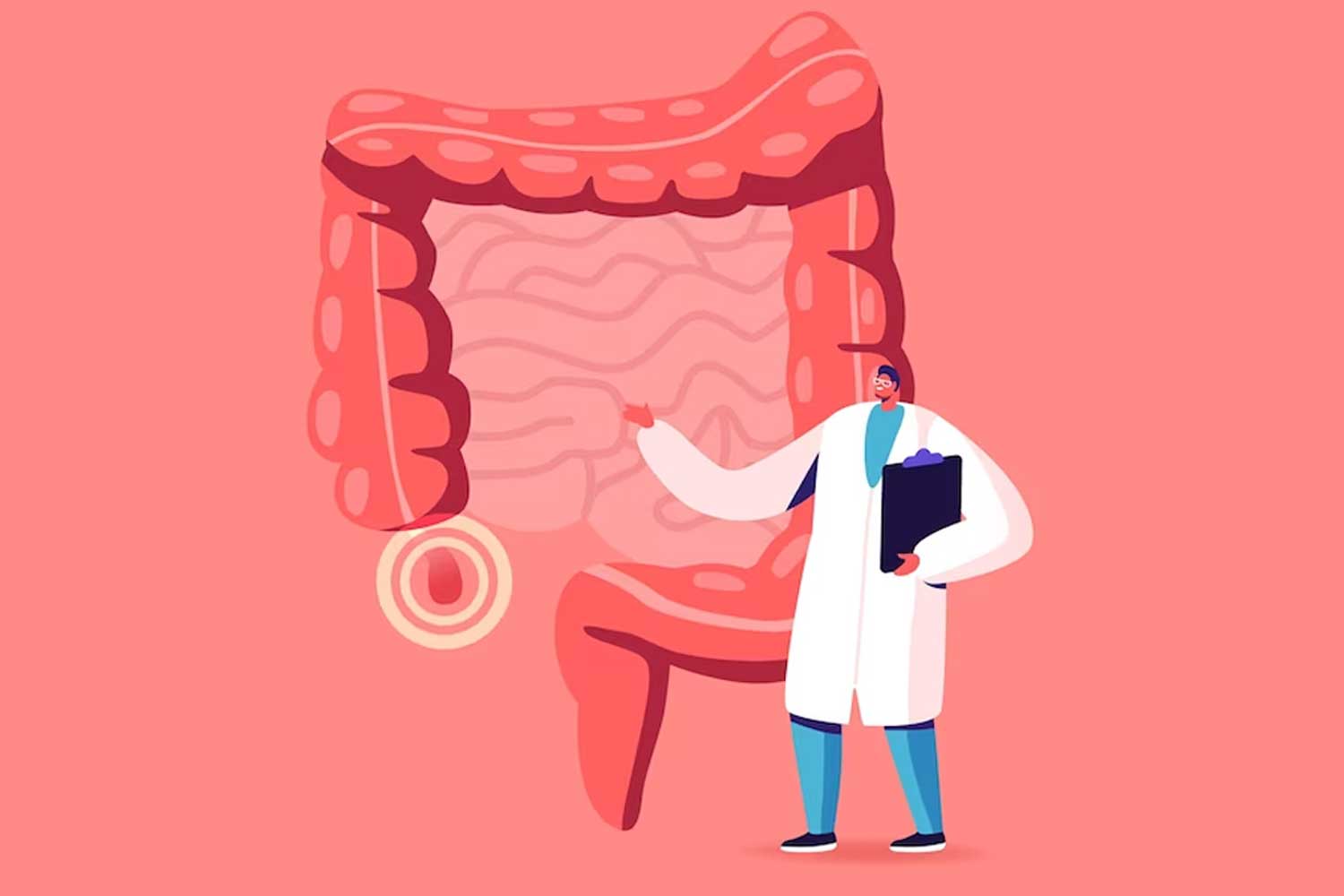 Appendix cancers see rise among millennials: New study reveals
