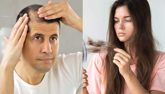 Hair loss explained: Causes, symptoms, and when to see a doctor