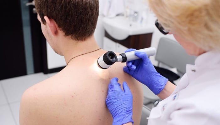 New AI tool provides accurate skin cancer diagnoses, study